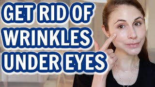 How to GET RID OF UNDER EYE WRINKLES Dr Dray [upl. by Nosae]