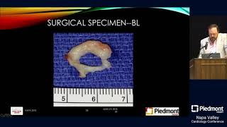 A Surgeons Tips for Subarotic Stenosis [upl. by Hildebrandt]