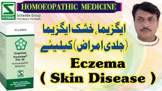 PTK 50 Graphites Pentarkan  DrWillmar Schwabe Germany  Homoeopathic Medicine  Urdu Hindi [upl. by Aicillyhp740]