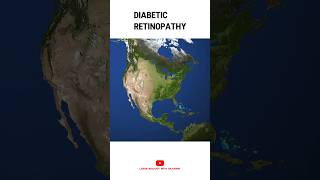 What is Diabetic Retinopathy 👁️ [upl. by Wilonah]