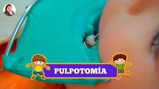 PULPOTOMÍA para NIÑOS 👦🏻  ODONTOPEDIATRÍA 😀  CLÍNICA DENTAL Hada 🧚🏻 [upl. by Higginson]