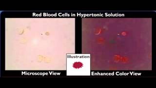 hemolysis crenation [upl. by Copp]