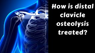 How is distal clavicle osteolysis treated [upl. by Tavish]