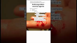 Anticoagulation reversal agents [upl. by Suissac631]