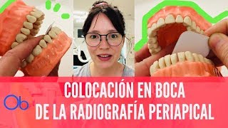 Cómo colocar las Radiografías Periapicales en boca 👄 [upl. by Aschim118]