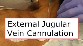 External Jugular Vein Cannulation [upl. by Harve]