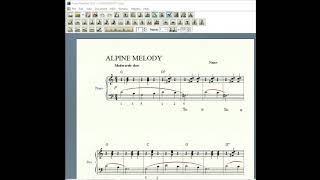 How to add a crescendo and decrescendo marking MuseScore 3 and Finale NP 2012 [upl. by Burgener]