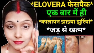 Skin Care Remedy for Melasma Treatment कितनी भी पुरानी झाइयों को 7 दिन में ठीक करें  eloveraface [upl. by Docia]