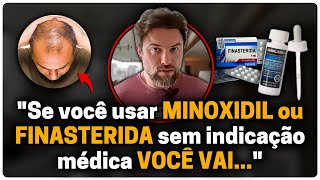 MINOXIDIL e FINASTERIDA realmente funcionam contra QUEDA DE CABELO [upl. by Gader]