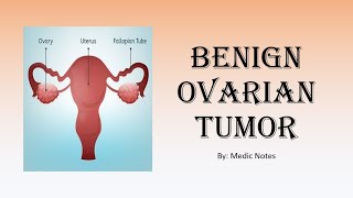 OampG Benign ovarian tumor  classification clinical features investigation treatment [upl. by Sivie]