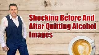 Shocking Before And After Quitting Alcohol Images [upl. by Eolcin153]