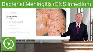 Bacterial Meningitis CNS Infection – Infectious Diseases  Lecturio [upl. by Hoffarth]