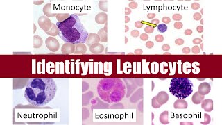 Adhesion in Leukocyte Extravasation [upl. by Elleinaj]