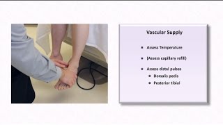 The Diabetic Foot Exam [upl. by Athallia]