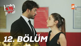 Kalp Yarası 12 Bölüm atv [upl. by Dlanigger]