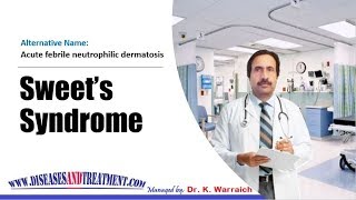 Sweet’s Syndrome  Causes Diagnosis Symptoms Treatment Prognosis [upl. by Selemas]