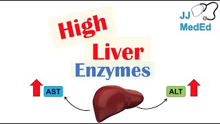 High Liver Enzymes  Aspartate vs Alanine Aminotransferase AST vs ALT  Causes [upl. by Darcey]