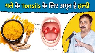 गले के टोंसिल Tonsils का नहीं करवाना होगा ऑपरेशन कुछ ही दिनों में ठीक करेगी हल्दी  Rajiv Dixit [upl. by Ettenaej528]