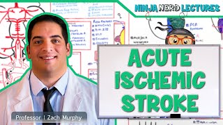 Acute Ischemic Stroke Etiology Pathophysiology Clinical Features Diagnostics Treatment [upl. by Asamot]