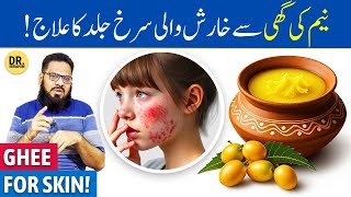 Neem Ki Desi Ghee Ke Fayde For Skin  Neem Desi Ghee Benefits  Dr Ibrahim [upl. by Chicky721]