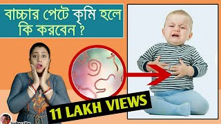 How to treat worm infection in children in Bengali  শিশুদের কৃমি সমস্যা ও সমাধান  Home remedies [upl. by Tayler]