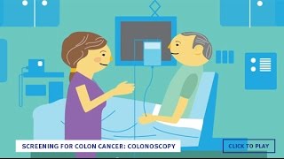 Screening for Colon Cancer Colonoscopy English [upl. by Hunsinger]