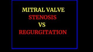 MITRAL STENOSIS VS REGURGITATION [upl. by Earaj]