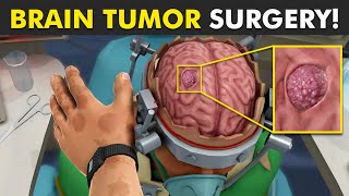 How Brain Tumor Is Removed From Brain Through Surgery [upl. by Becky]