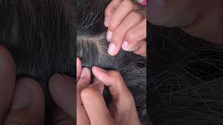 Lice picking hair headlice haircare headliceremoval louse headlicetreatment short1 [upl. by Holmes]