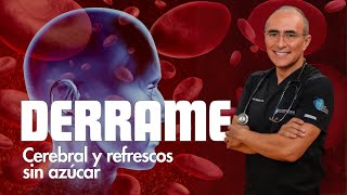 Derrame Cerebral y Refrescos sin azucar Lo Que Debes Saber [upl. by Meridel537]