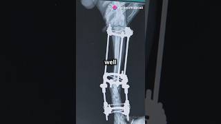 Biomaterials part 1 materialsscience biomaterials materialsengineering [upl. by Akilam886]