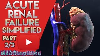 Acute Renal Failure Made Easy Part 22 [upl. by Ilwain432]