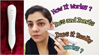 How to Remove Moles Using A Mole Remover Pen  Get Rid Of Moles at Home with this Product Instantly [upl. by Mairym]