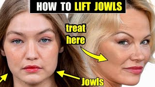 How to Lift amp Tighten the Jowls with SculptraFDA Proven to Tighten Skin amp Improve Jawline Contour [upl. by Alie877]