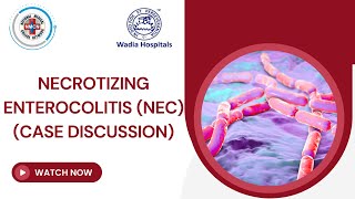 Necrotizing Enterocolitis NEC  Case Discussion [upl. by Asoj745]