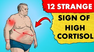 12 Unusual Signs of High Cortisol Levels [upl. by Aitrop408]