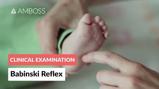 Babinski Reflex in Infants  Clinical Examination [upl. by Zoila]