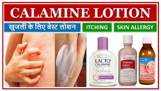 CALAMINE LOTION खुजली के लिए बेस्ट लोशन ITCHING SKIN ALLERGY INSECT BITES ECZEMA SKIN LOTION [upl. by Inuat]