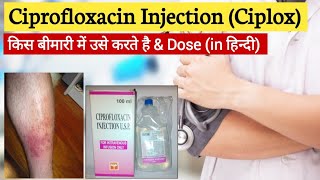 Ciprofloxacin injection uses in Hindi  Ciprofloxacin iv uses  Ciprofloxacin I [upl. by Annairdna]