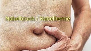 Nabelbruch oder Nabelhernie Ursachen und Risikofaktoren Therapie und Vorbeugung [upl. by Anuala]