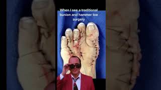 WTF Traditional Bunion Surgery Gone WRONG [upl. by Nnylaehs]