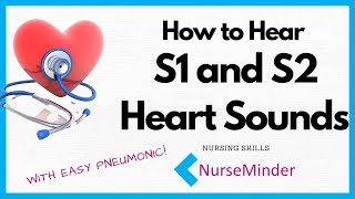 How to Hear S1 and S2 Heart Sounds [upl. by Ennovehc892]