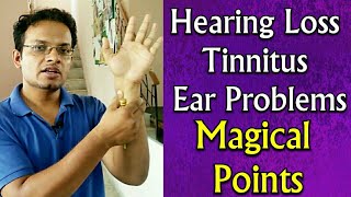 Acupressure Points For All EAR Problems  Hearing Loss  TINNITUS  Ear Pain  Deafness  In Hindi [upl. by Trebleht]