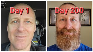 Time Lapse Beard Growth 4 Months [upl. by Alitha203]