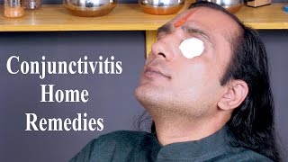 Conjunctivitis Treatment  How To Cure Conjunctivitis  Home Remedies For Conjunctivitis [upl. by Yelrebma485]