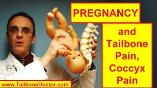 TAILBONE PAIN During PREGNANCY [upl. by Aznerol]