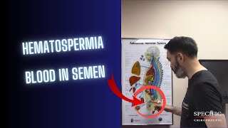 Hematospermia BLOOD in Semen HELPED at Specific Chiropractic NYC [upl. by Nosneh]