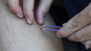 Mayo Clinic Minute Tips to best remove ticks [upl. by Eleirbag530]