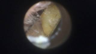 What is in this Ear [upl. by Brander]