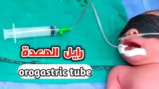 تعلم تركيب رايل المعدة للأطفالorogastric tube insertion procedure [upl. by Ahsienel]